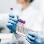 A lab tech slides a test tube into a rack containing other tubes - How Long Does Ritalin (Methylphenidate) Stay In Your System?