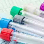 A set of test tubes with different colored caps lie on paperwork - How Long Does Xanax Stay In Your System